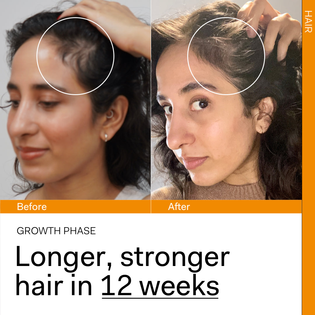 GROWTH PHASE