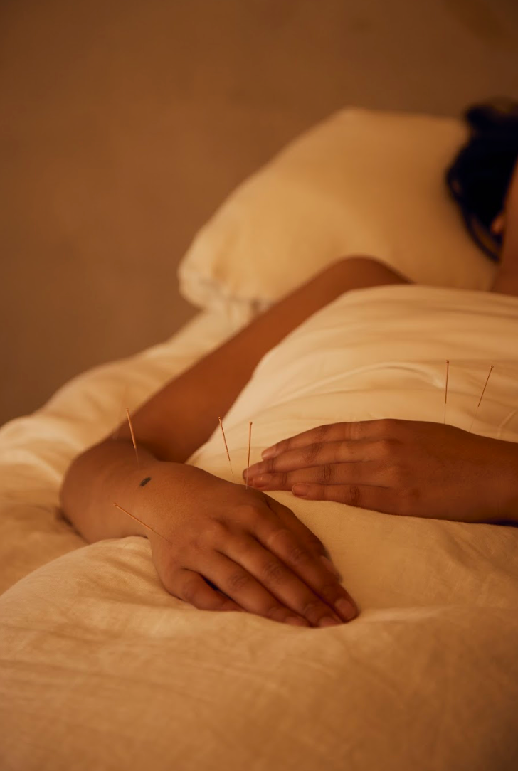 Full Body Balance - Acupuncture