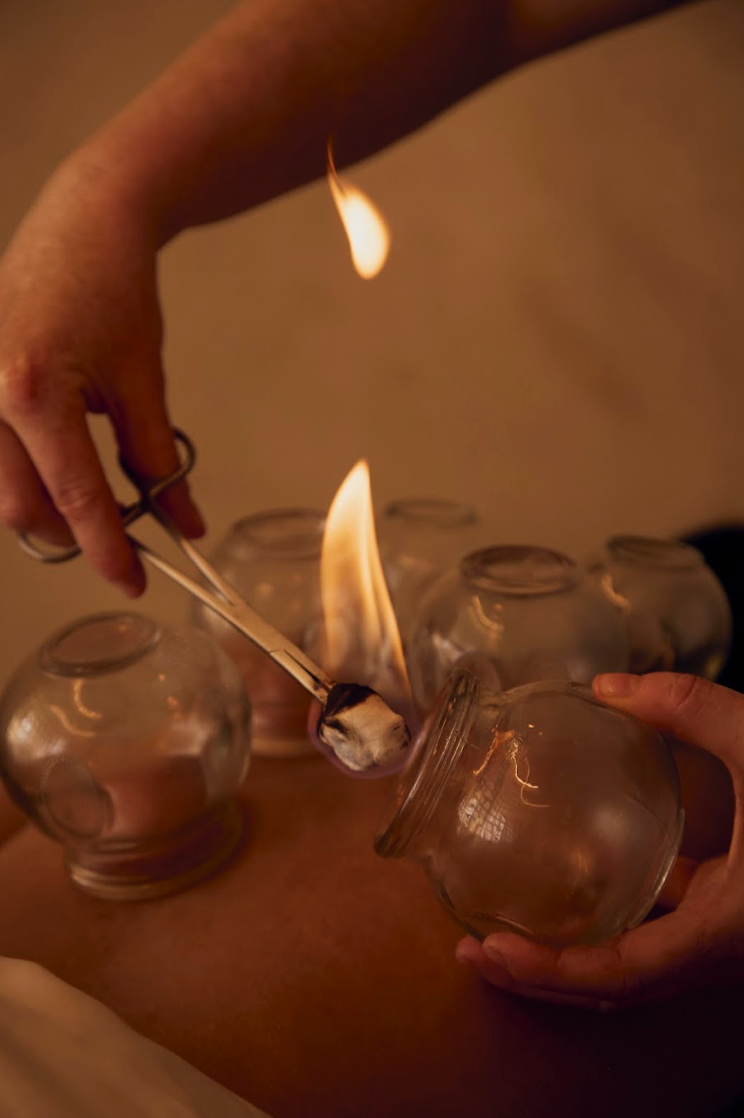 Full Body Fire & Flow - Acupuncture & Cupping
