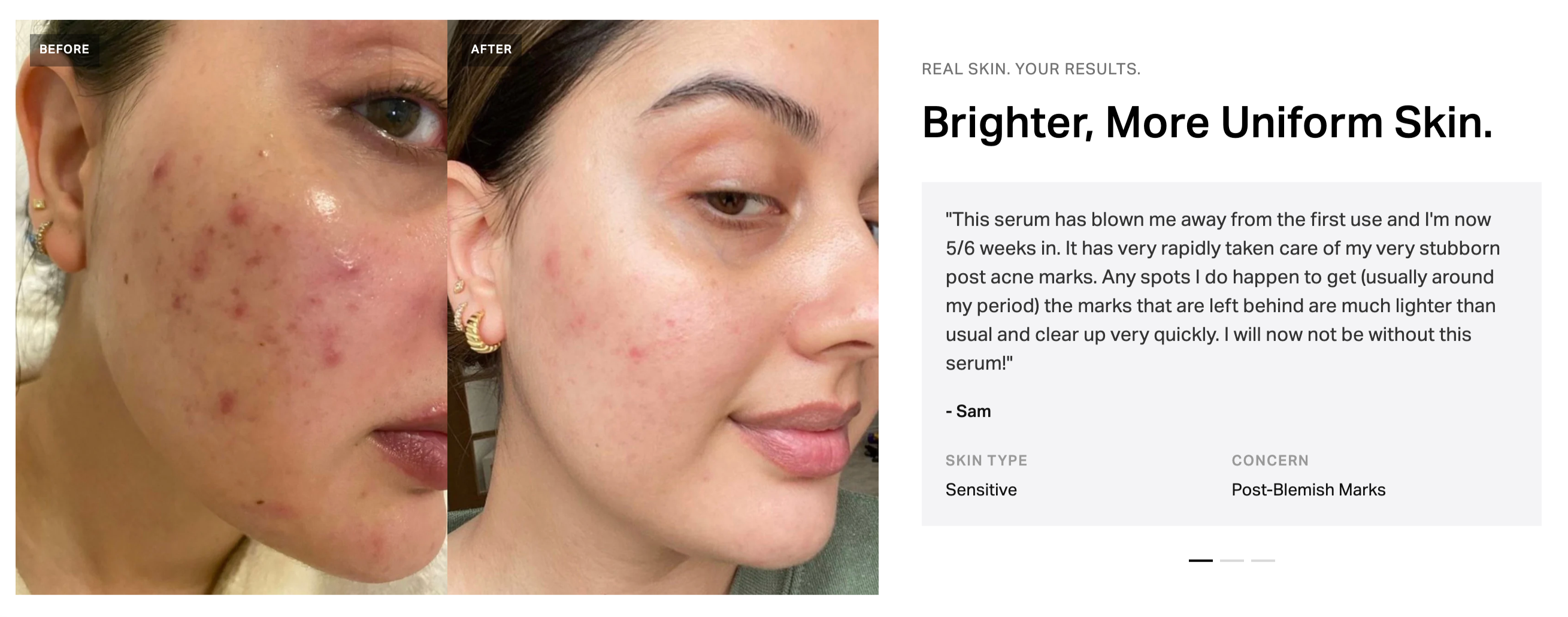 Pigmentation Corrector Serum