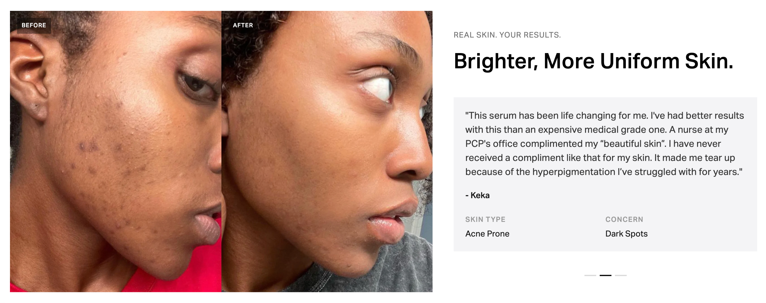 Pigmentation Corrector Serum