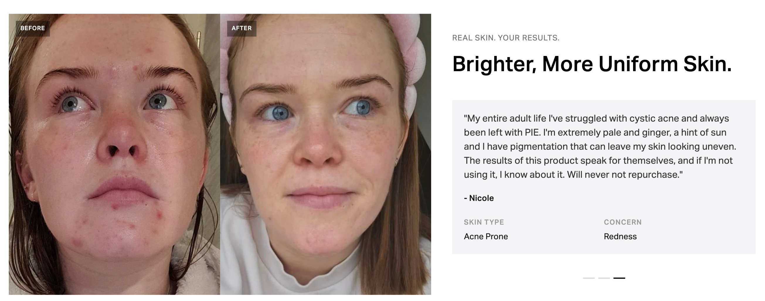 Pigmentation Corrector Serum
