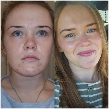 Pigmentation Corrector Serum