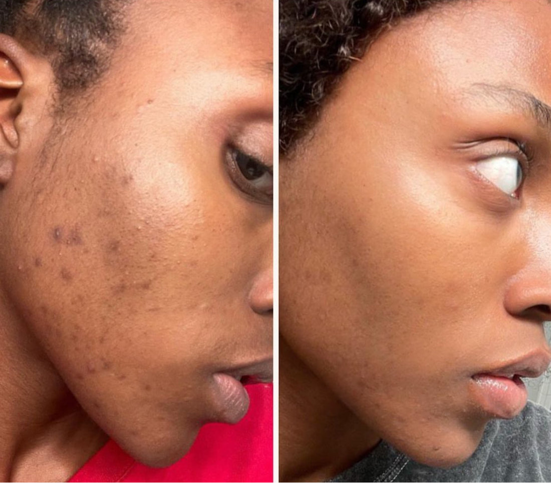 Pigmentation Corrector Serum