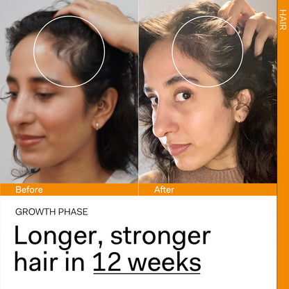 GROWTH PHASE