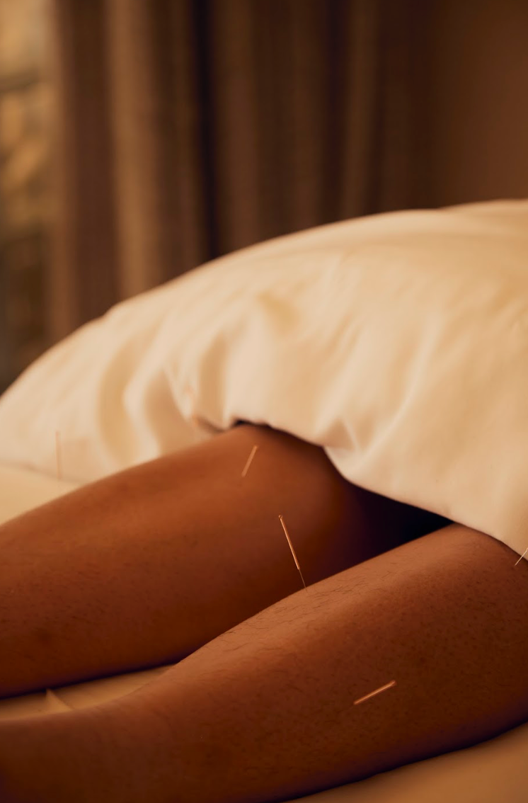 Full Body Balance - Acupuncture