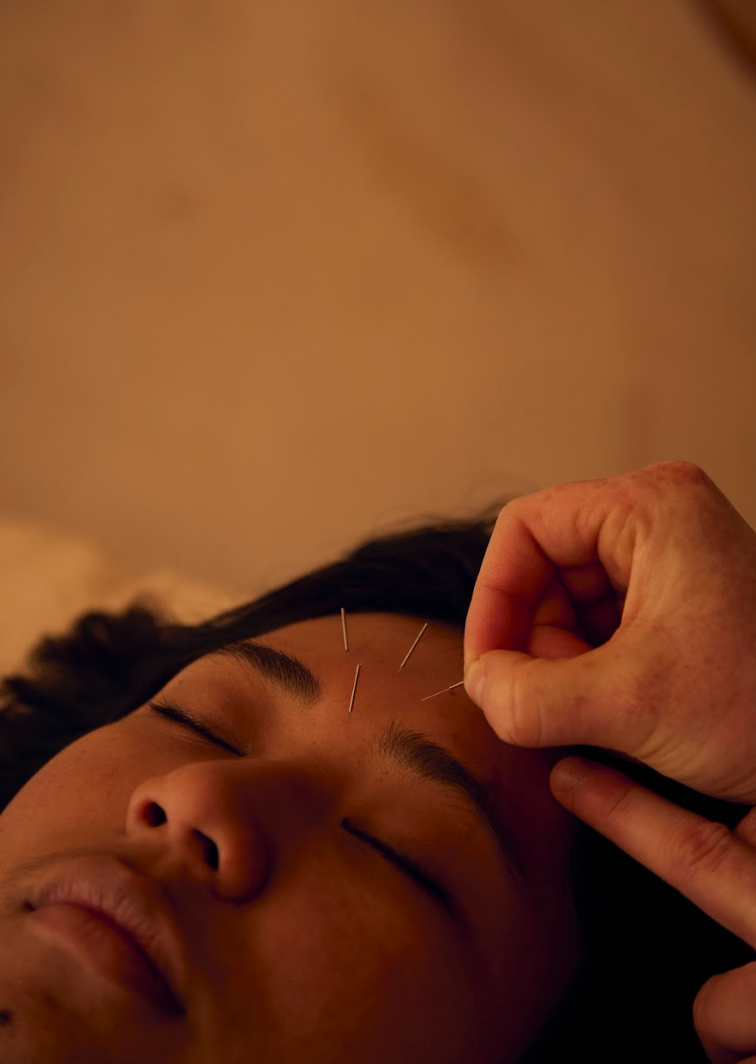Outside Glow, Inside Flow - cosmetic acupuncture