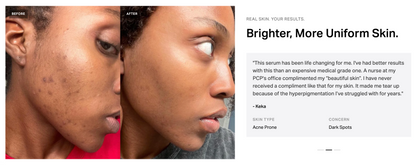 Pigmentation Corrector Serum