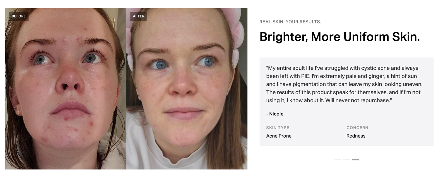 Pigmentation Corrector Serum