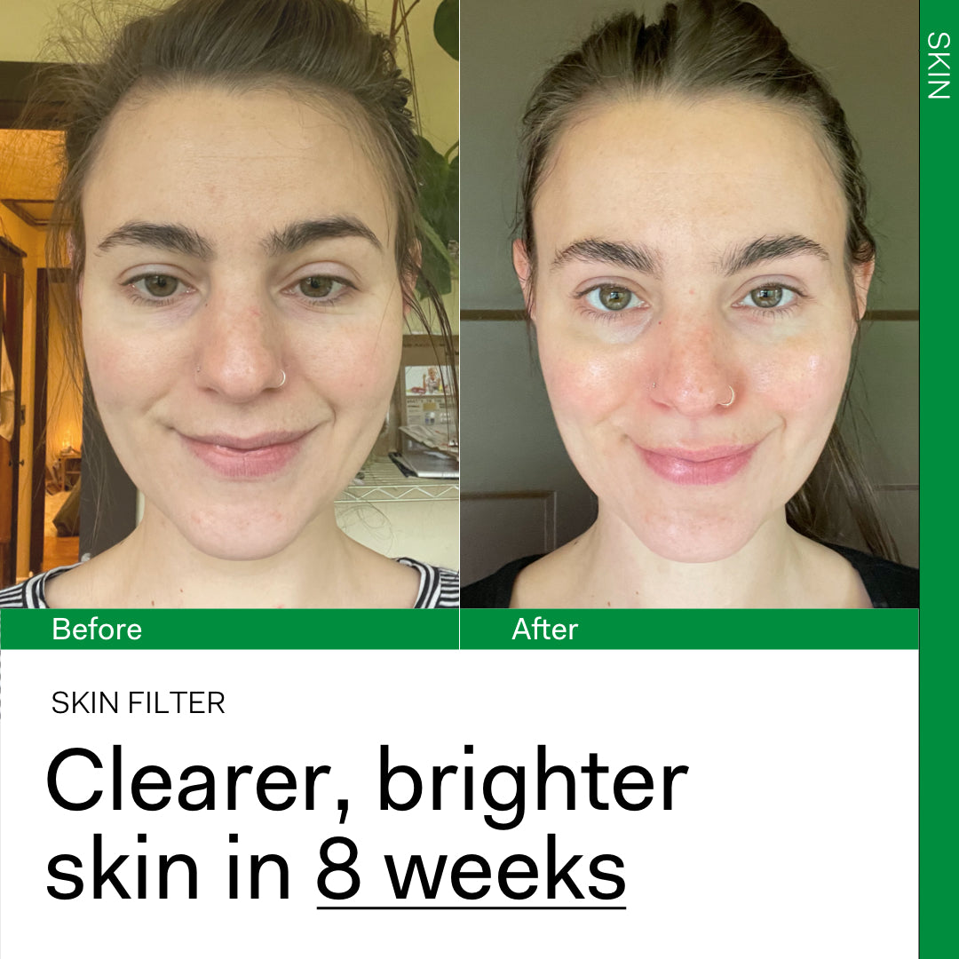 SKIN FILTER